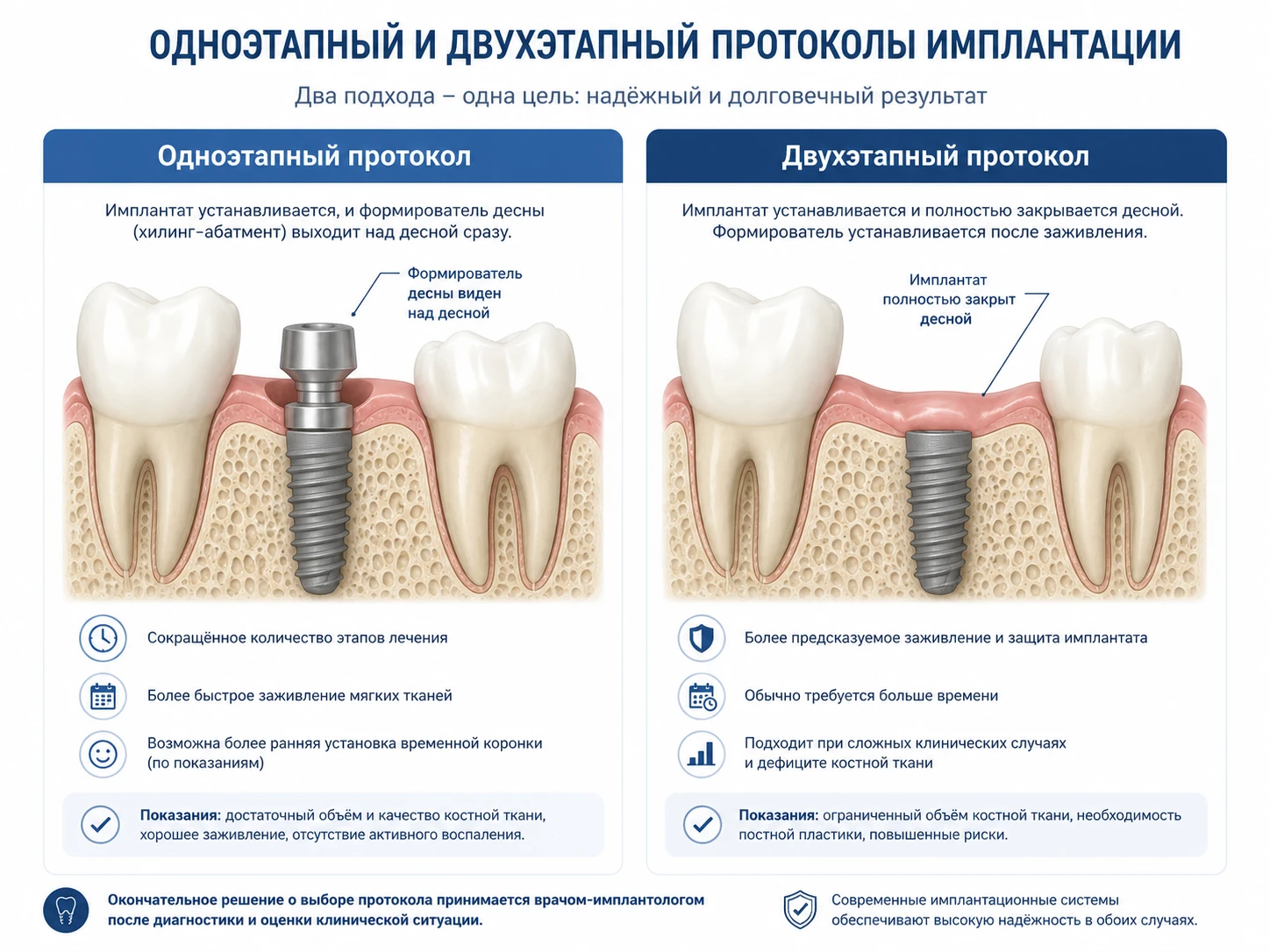 Схема отличий одноэтапной и двухэтапной имплантации